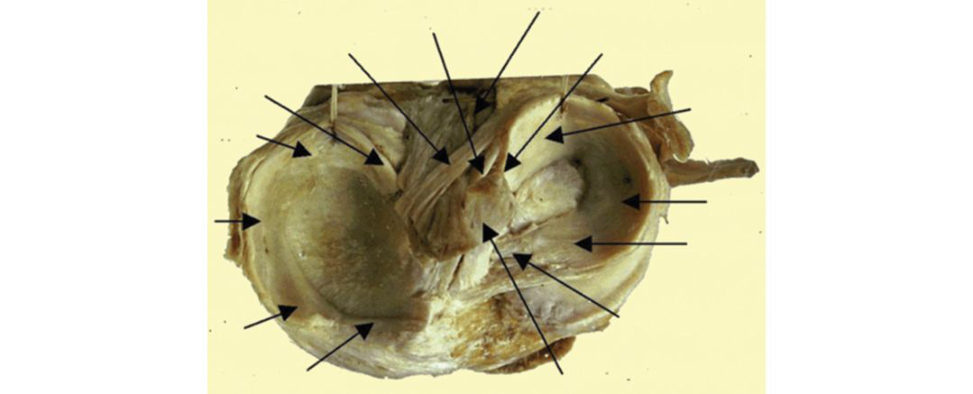 Figure 20.25