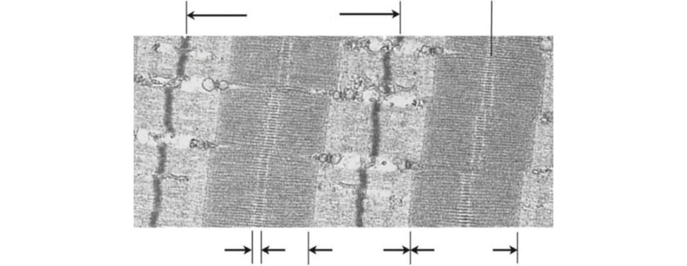 Figure 20.41