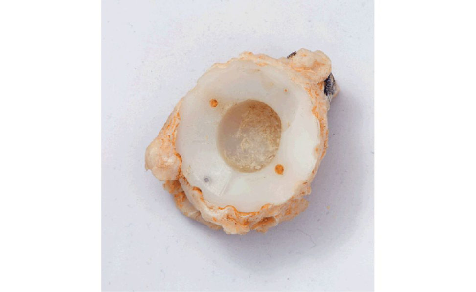 Figure 21.1