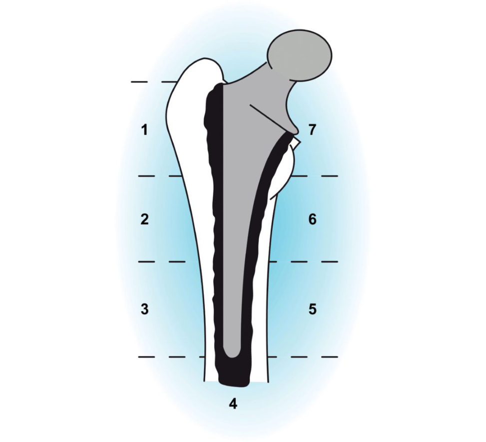 Figure 21.4