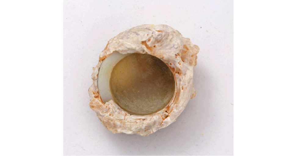 Figure 21.5