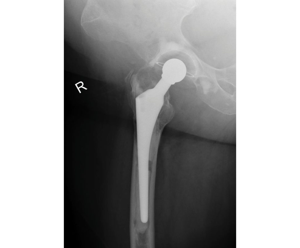 Figure 21.6