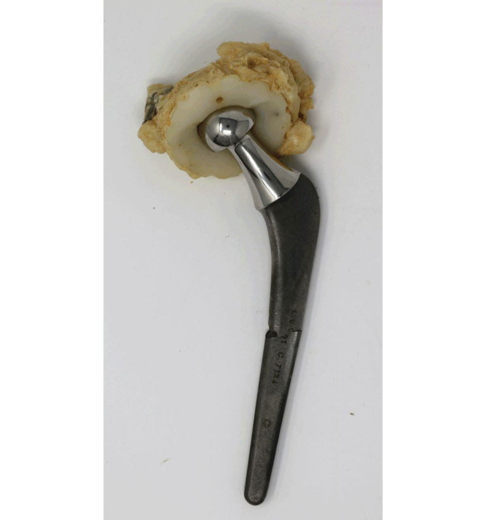 Figure 21.15