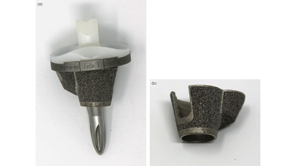 Figure 21.17a