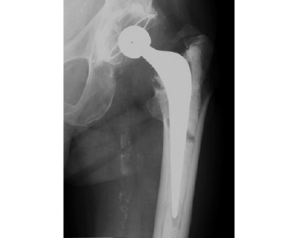 Figure 21.18