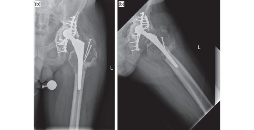 Figure 25.1