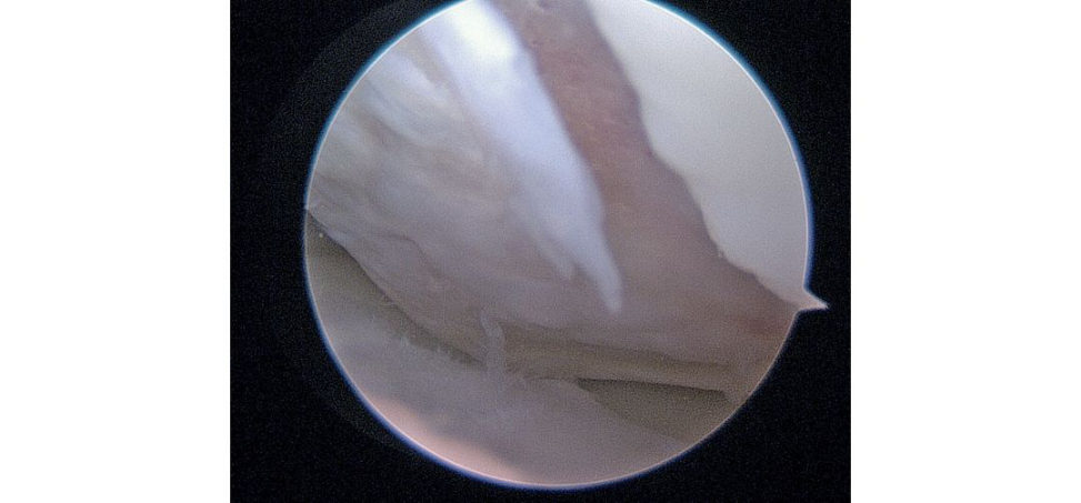 Figure 25.5