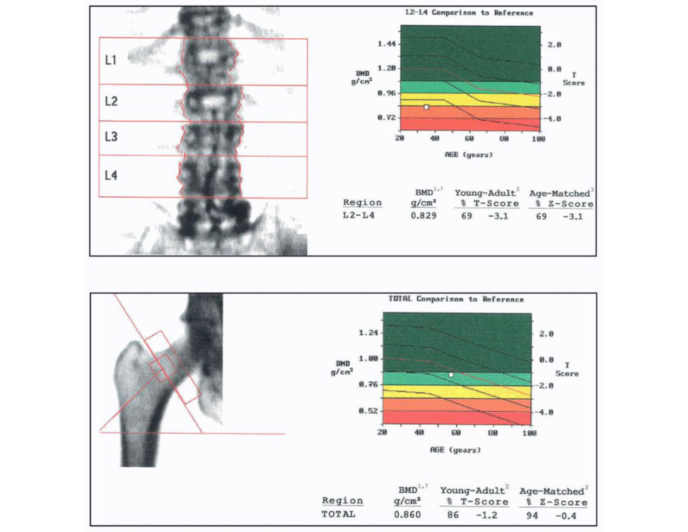 Figure 25.7