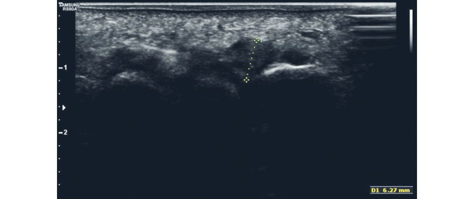 Figure 28.2