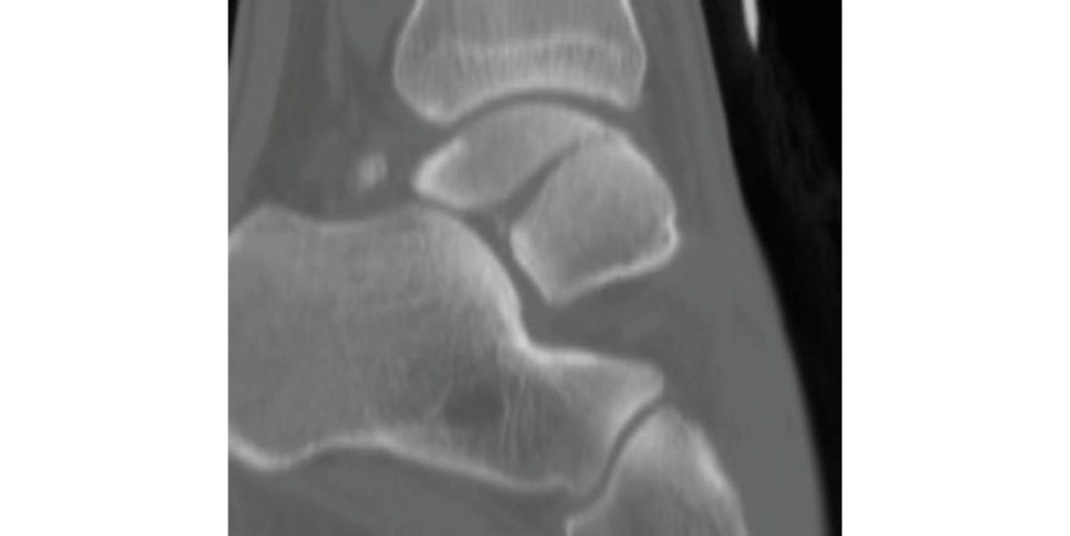 Figure 28.3