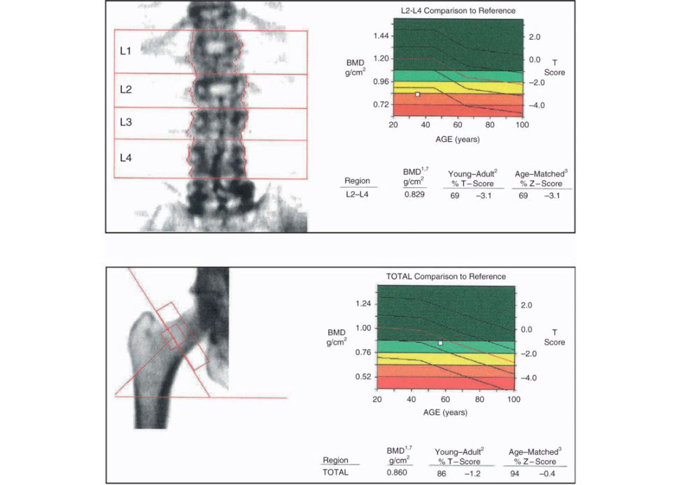 Figure 28.5