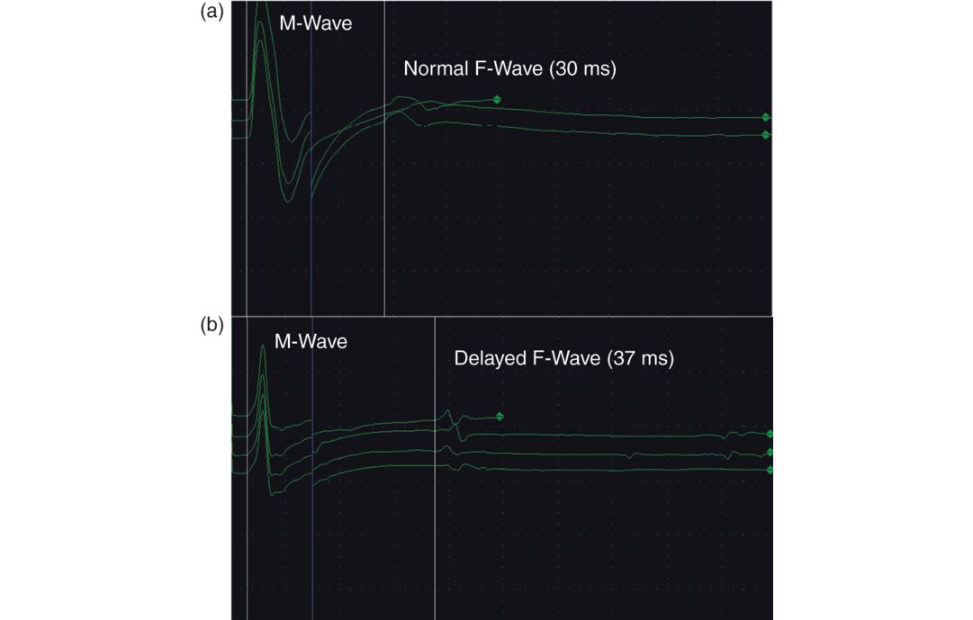 Figure 28.15
