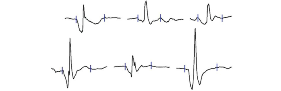 Figure 28.24