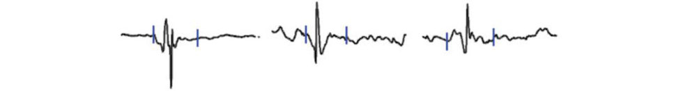 Figure 28.25