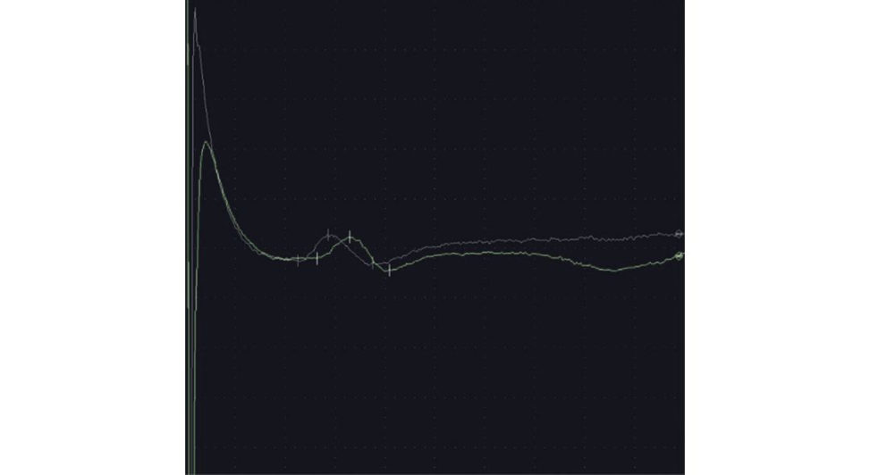 Figure 28.27