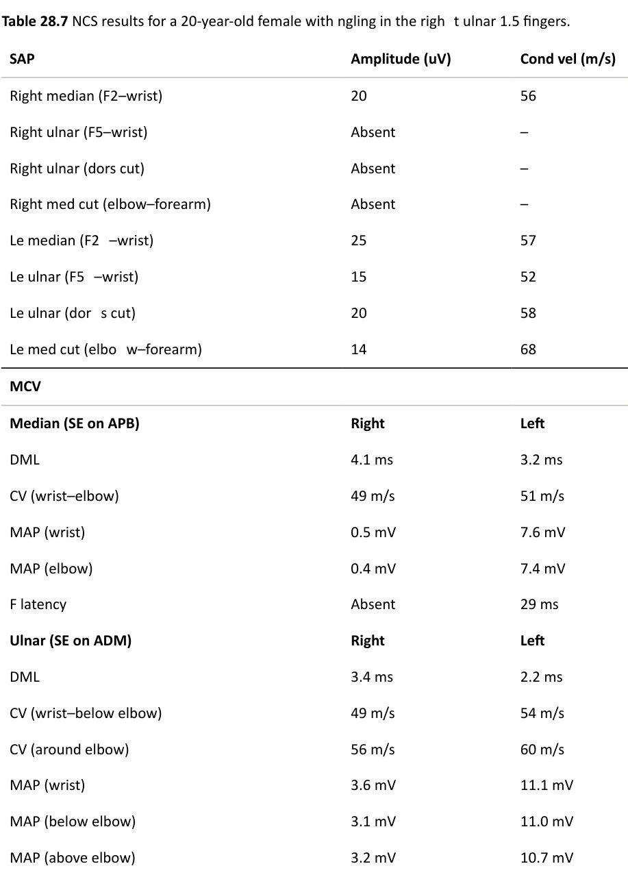 Table rendered from source
