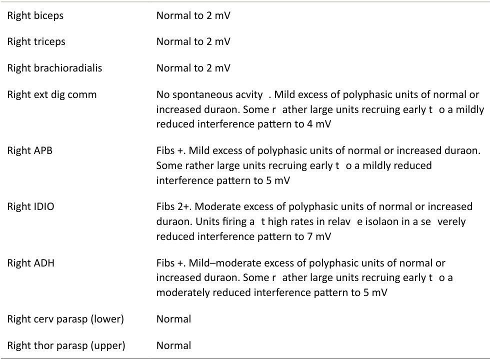 Table rendered from source