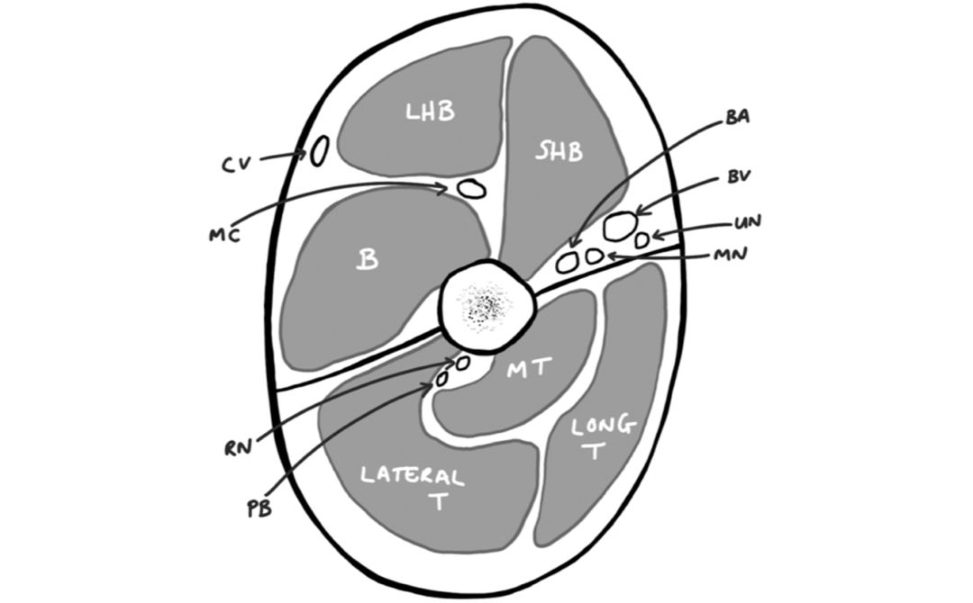 Figure 31.5