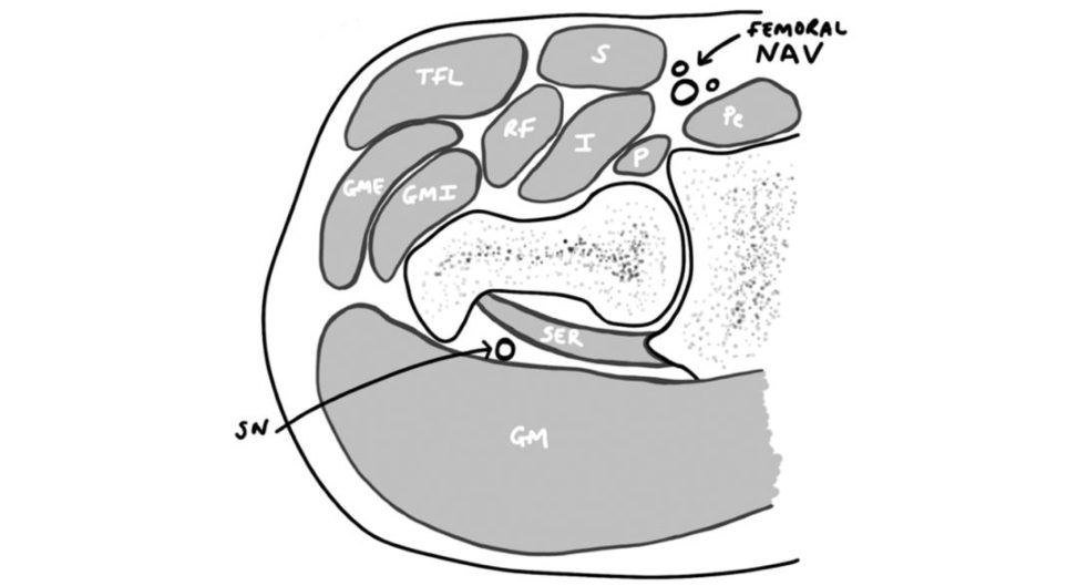 Figure 31.19