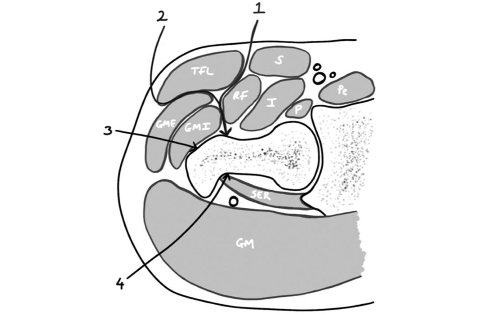 Figure 31.20