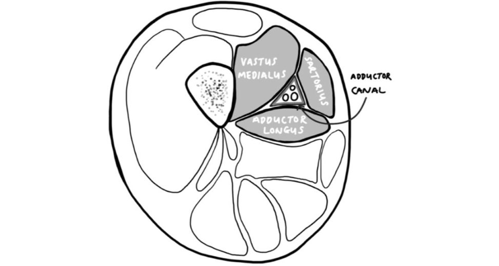 Figure 31.21