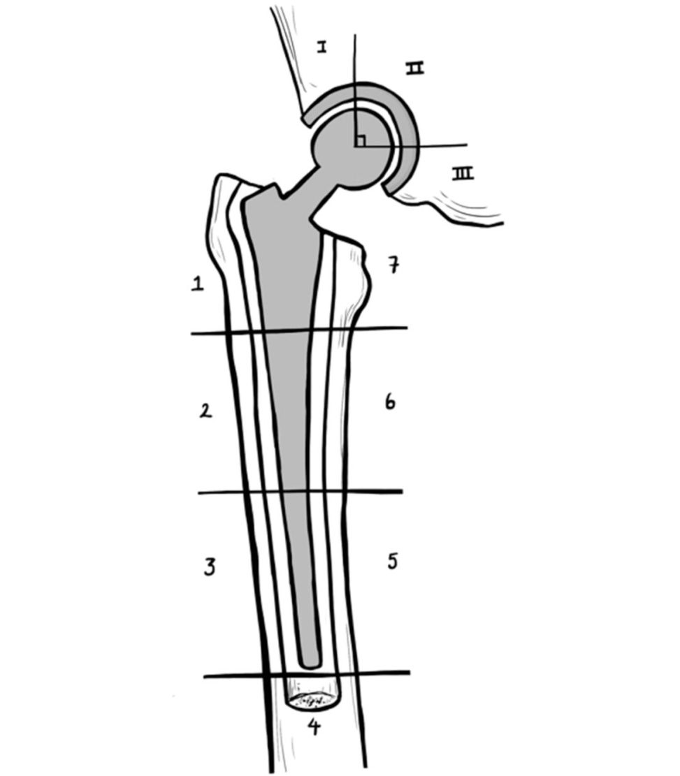 Figure 31.45