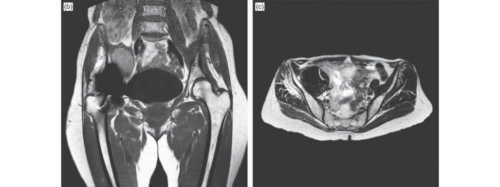 Figure 3.2b