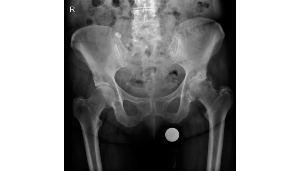 Figure 3.4