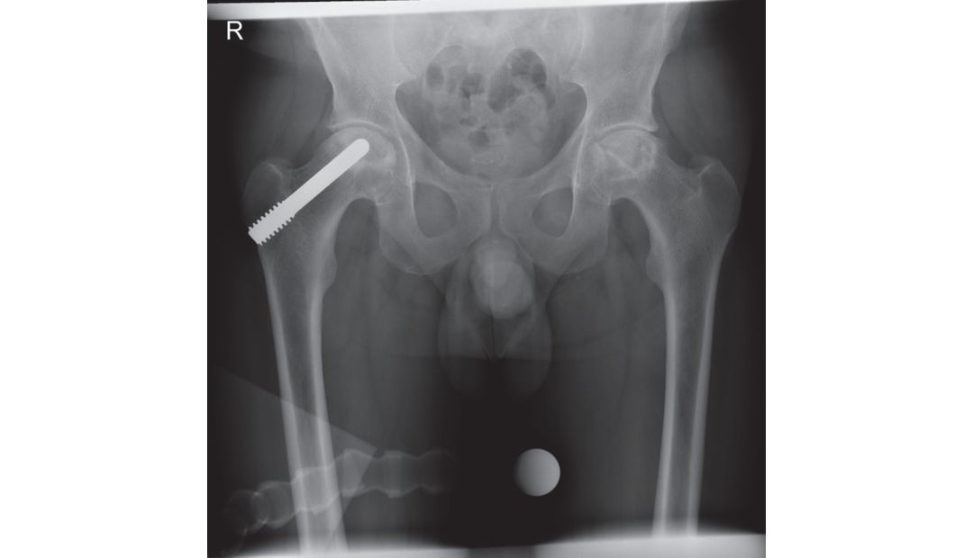 Figure 3.5b
