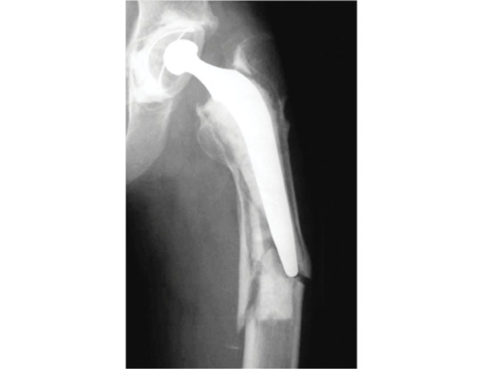 Figure 3.9a