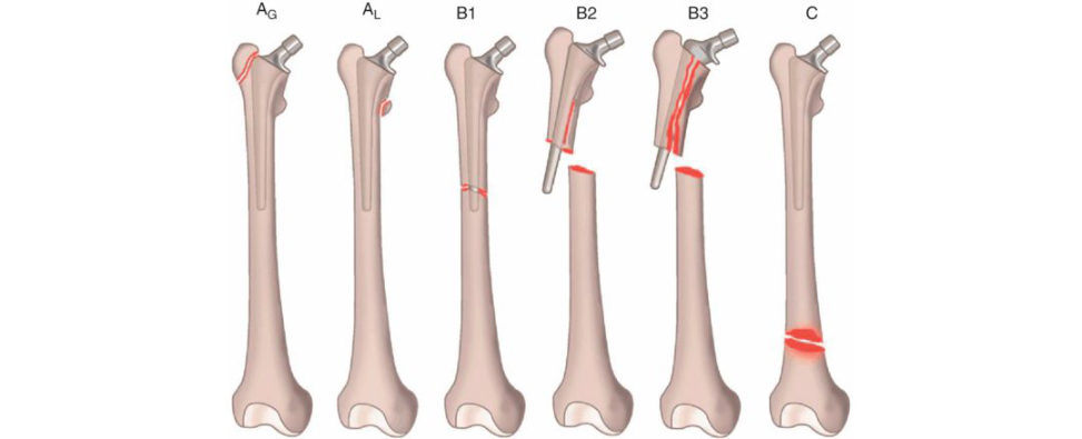 Figure 3.9b