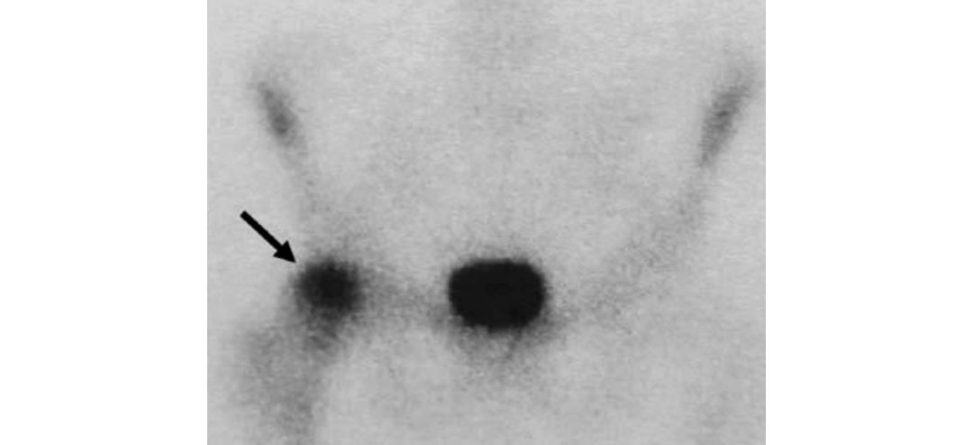 Figure 3.11b
