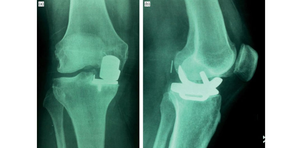 Figure 4.6a