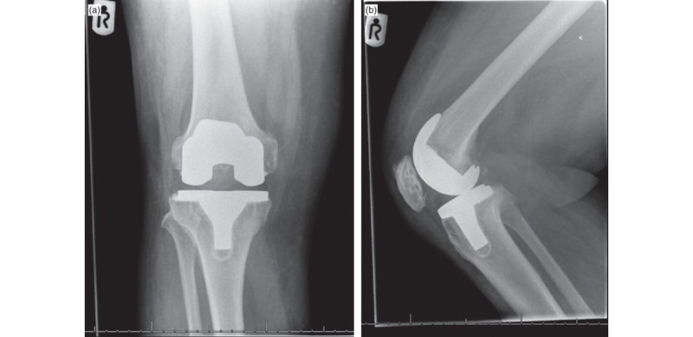 Figure 4.10a