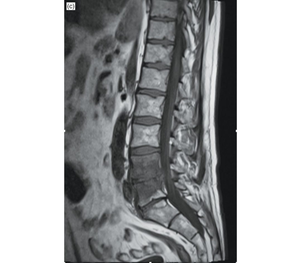 Figure 6.1c