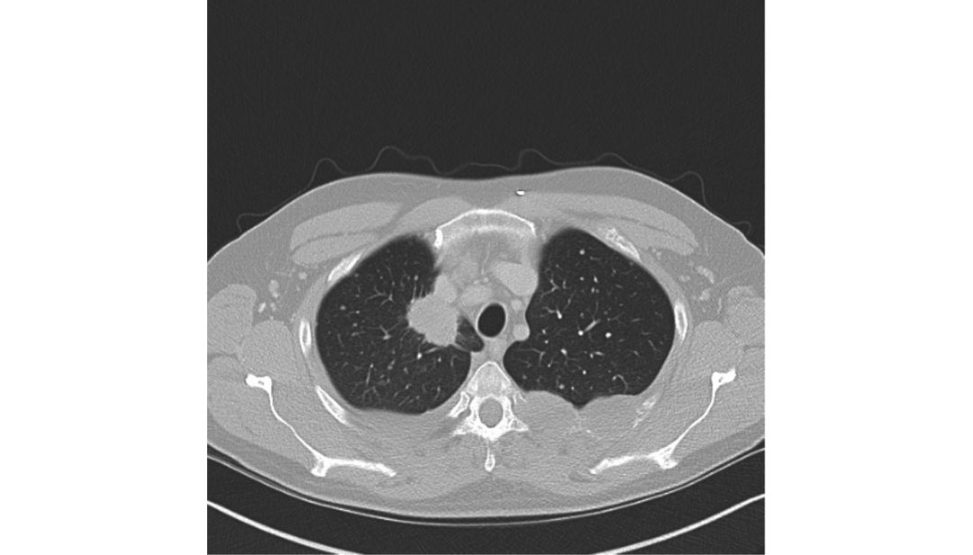 Figure 6.2c