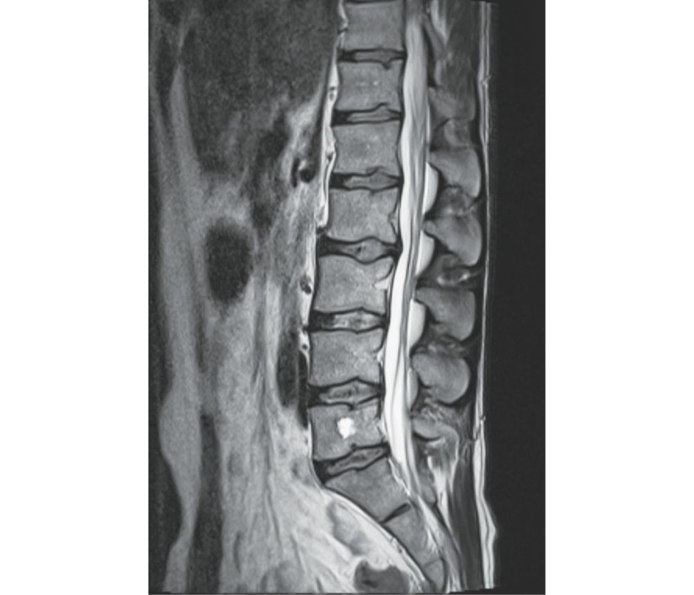Figure 6.3a