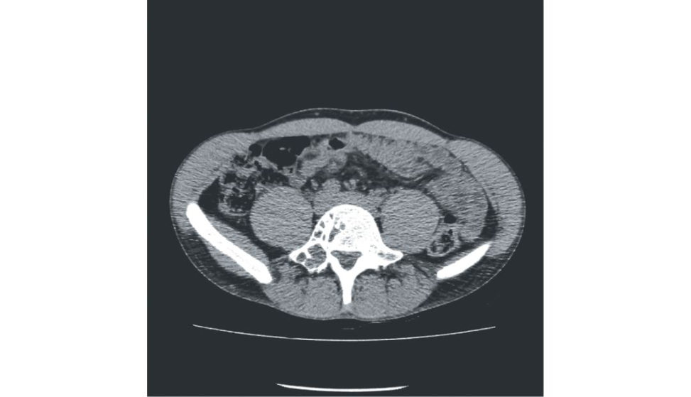 Figure 6.3e