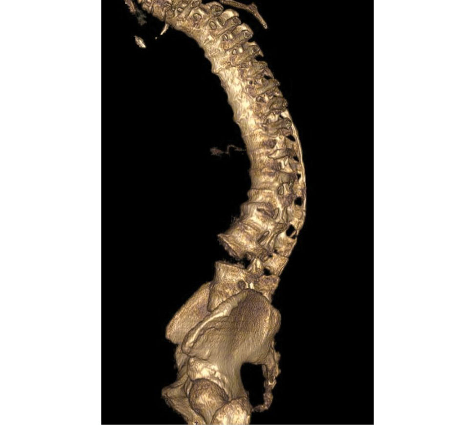 Figure 6.7c