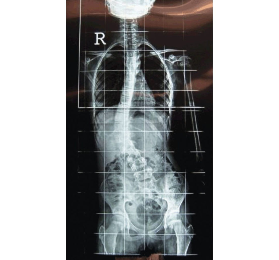 Figure 6.8a