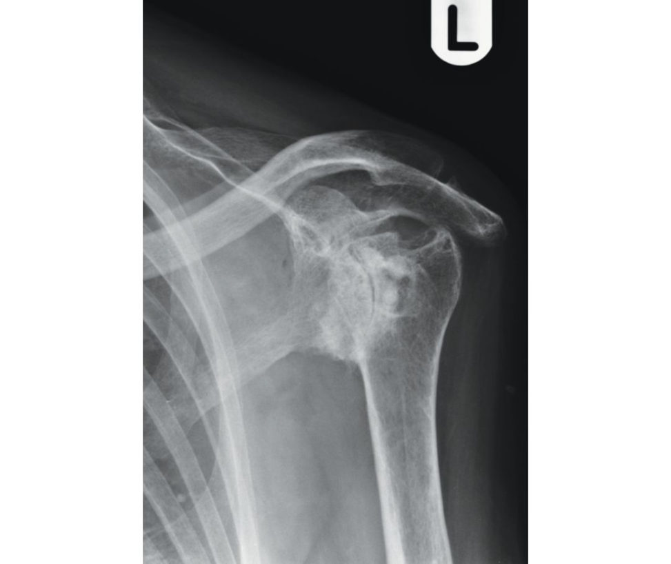 Figure 7.1