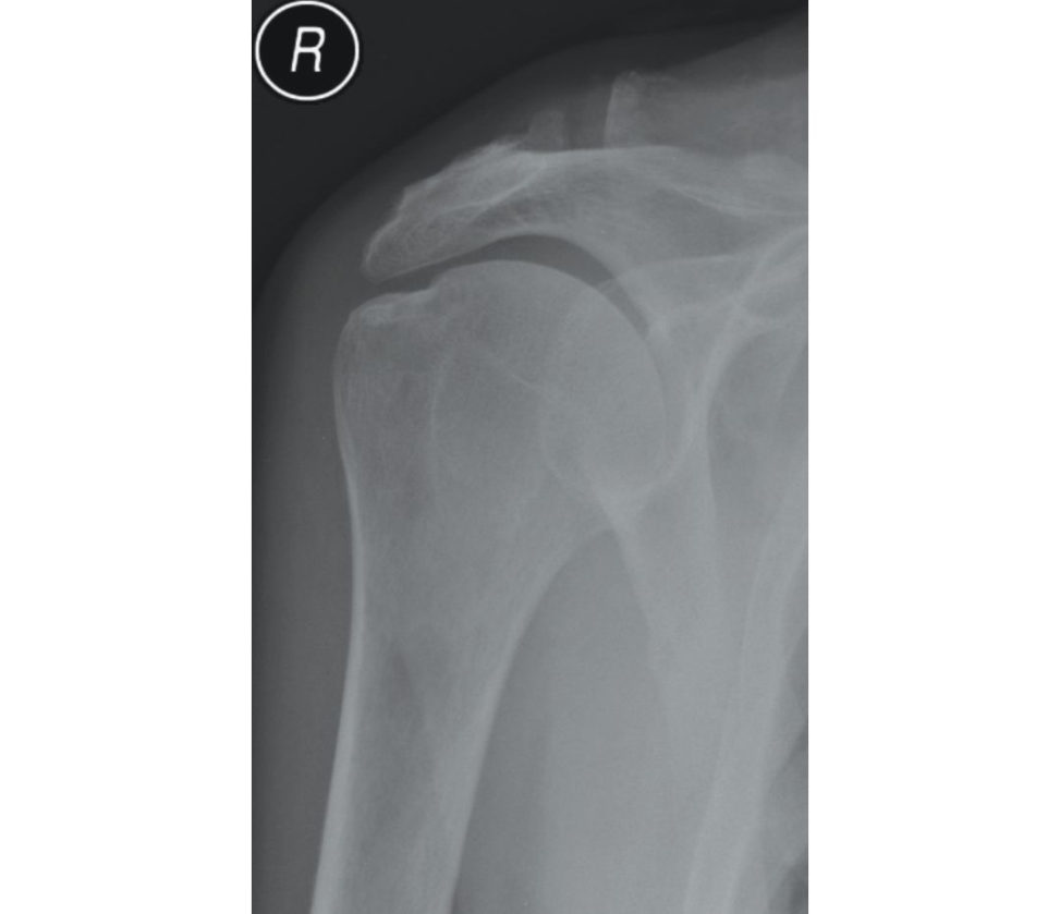 Figure 7.2