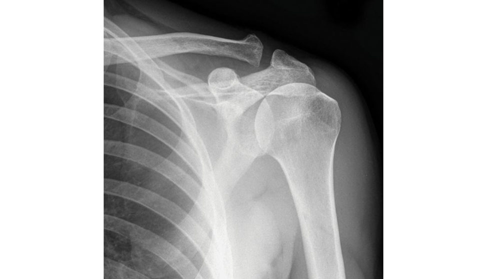 Figure 7.3a