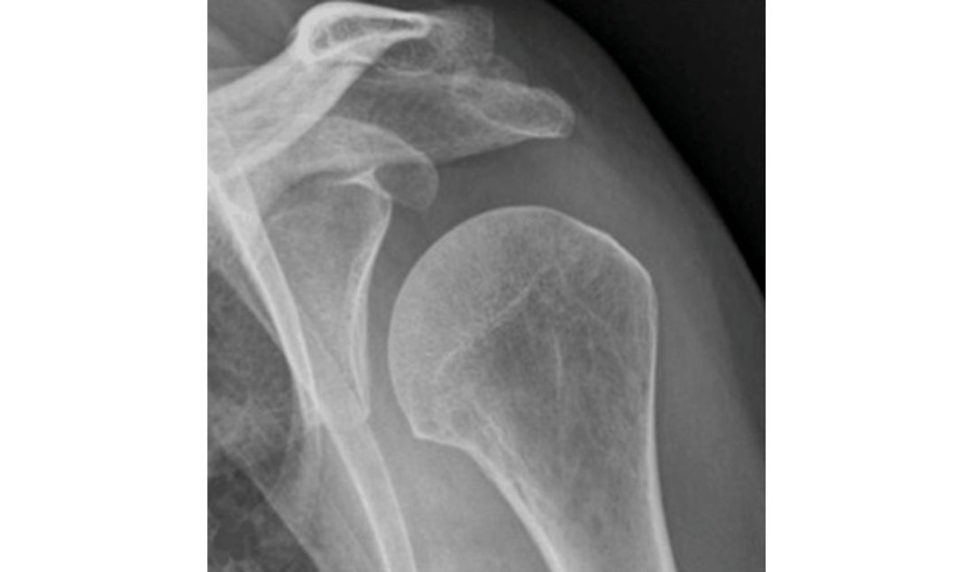 Figure 7.4a