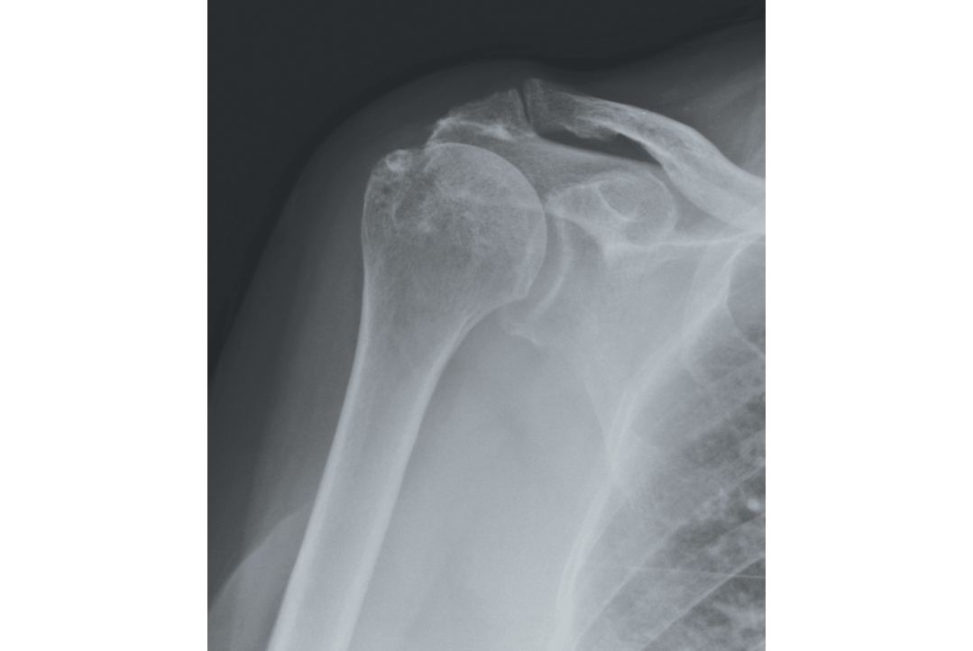 Figure 7.5a