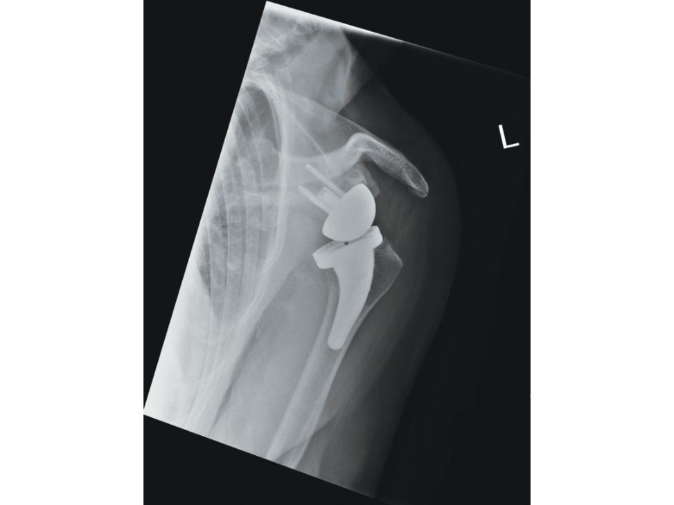 Figure 7.5b