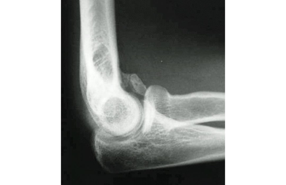 Figure 8.1
