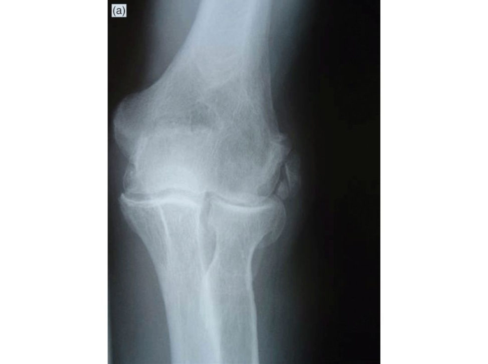 Figure 8.3a