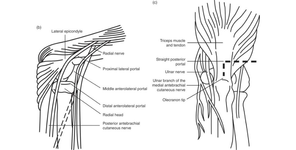 Figure 8.3b