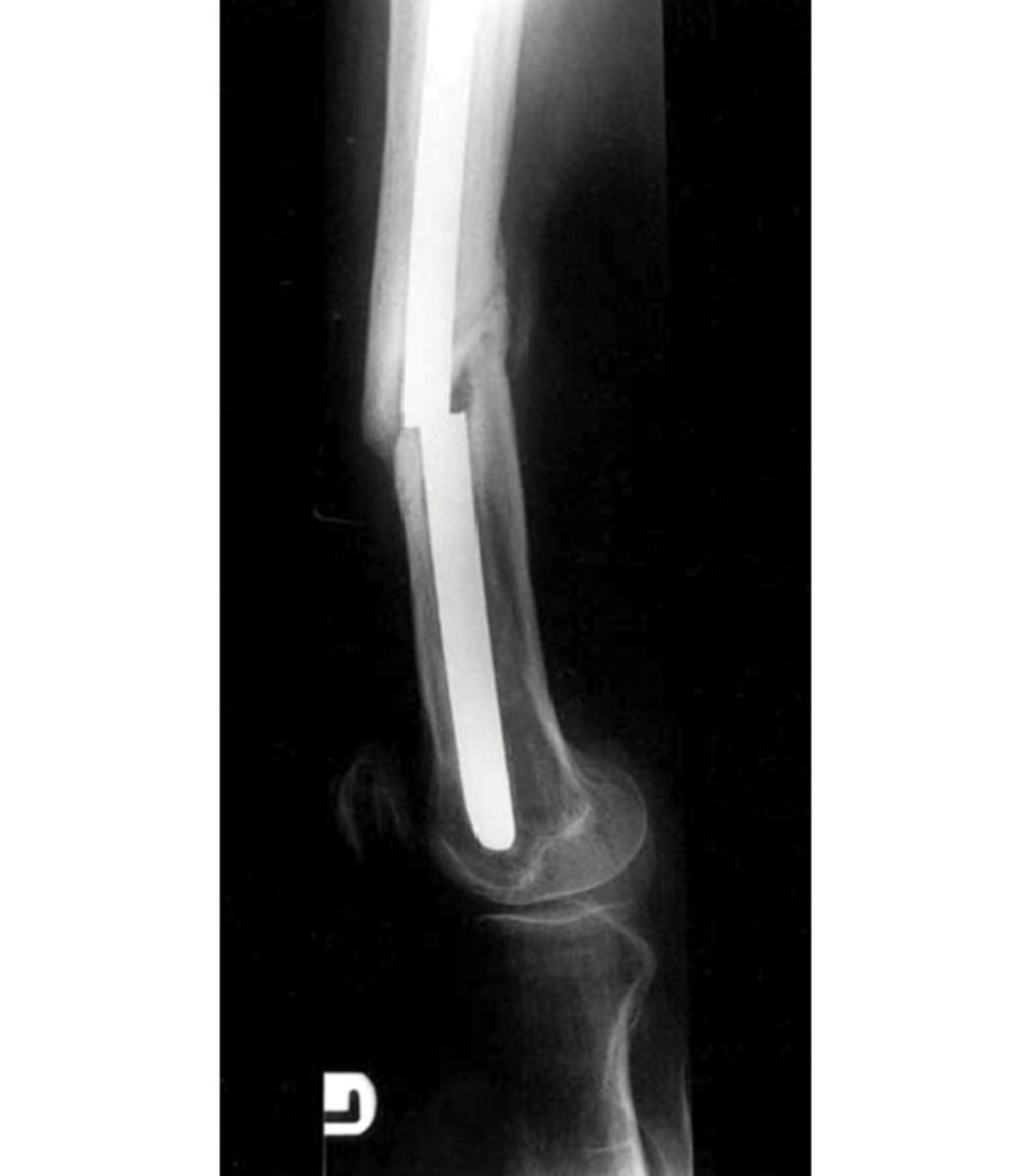 Figure 9.1